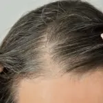 ودعي الشعر الأبيض.. أفضل وصفة لعلاج الشعر الأبيض والشيب في دقائق!!