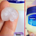 دون أي ألم.. مكونات وصفة الفازلين السحرية للتخلص من الشعر الزائد وتفتيح المناطق الغامقة