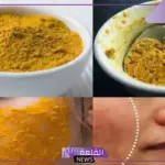 عالجي الكلف والبقع.. طريقة عمل وصفة الكركم والنشا لعلاج البقع والكلف