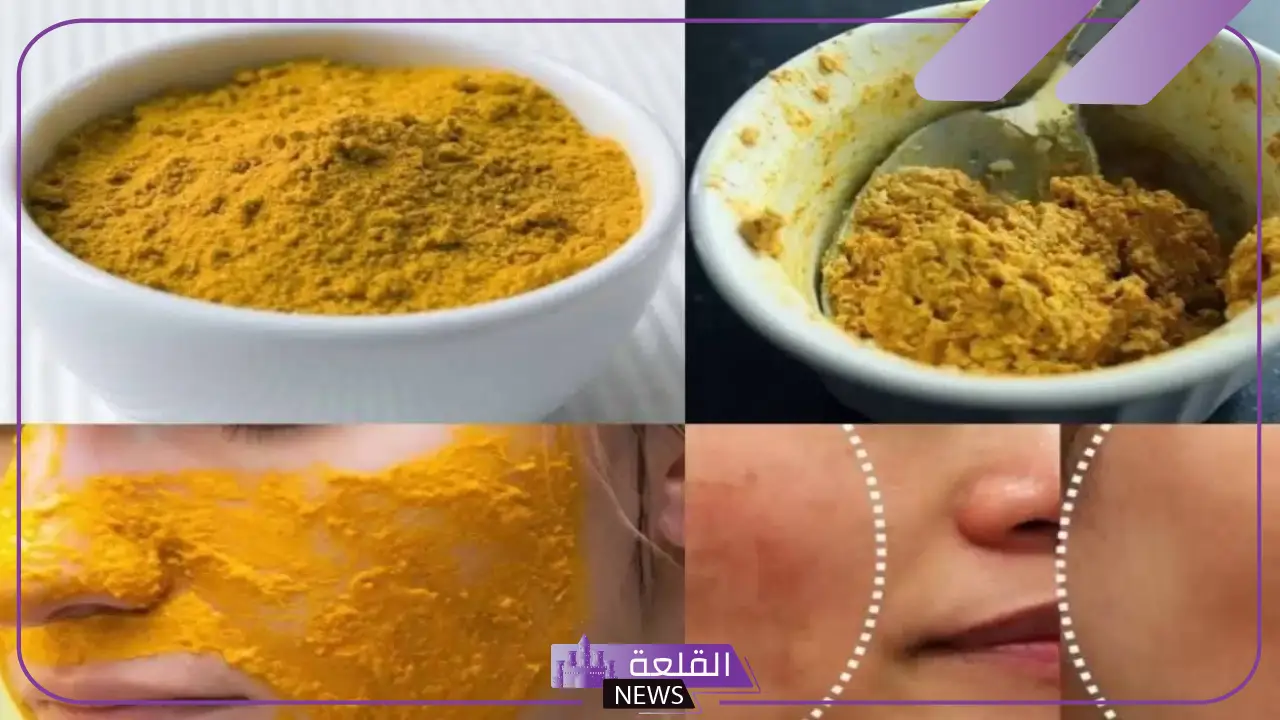 عالجي الكلف والبقع.. طريقة عمل وصفة الكركم والنشا لعلاج البقع والكلف