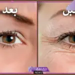 للتخلص من التجاعيد.. 4 أطعمة مفيدة غنية بالكولاجين