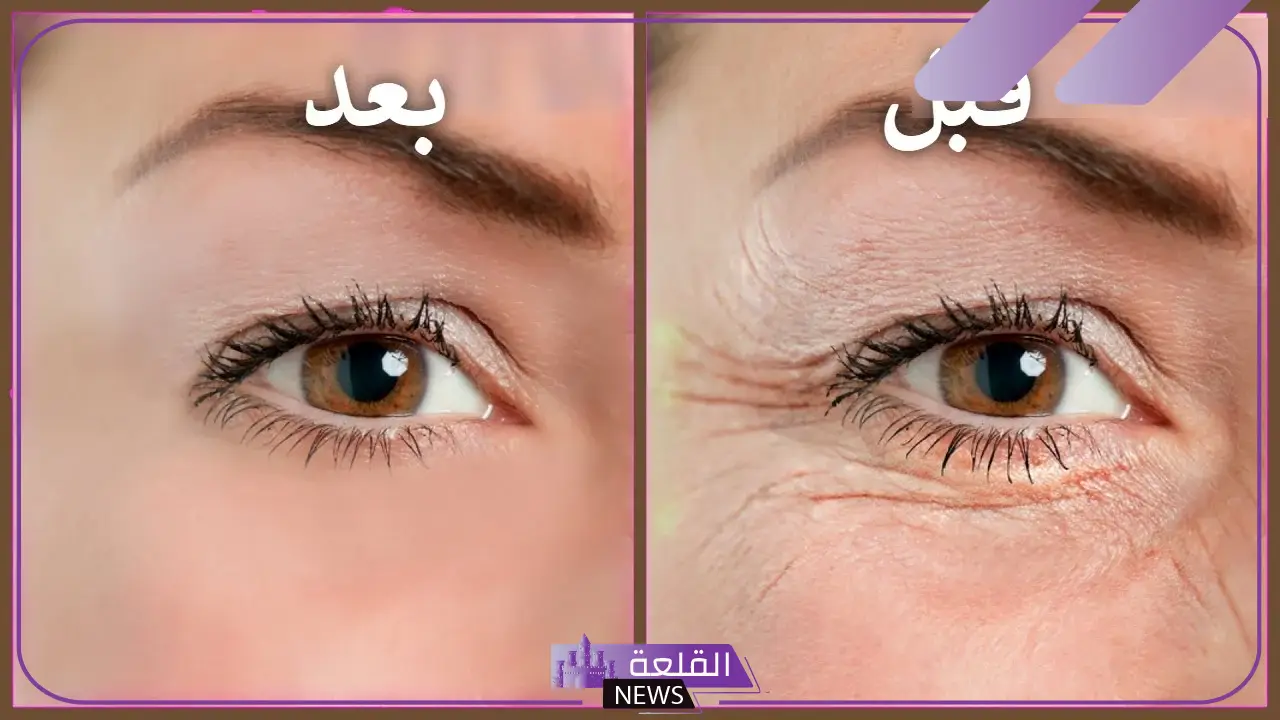 للتخلص من التجاعيد.. 4 أطعمة مفيدة غنية بالكولاجين