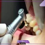 بالخطوات.. طريقة حجز موعد أسنان في المستشفى العسكري بالظهران