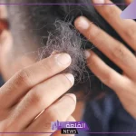 تفسير حلم الصلع في جزء من الرأس في المنام وعلاقته بحدوث الفرج 