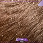 تفسير حلم القمل في الشعر وقتله للمتزوجه والتخلص منه لابن سيرين 