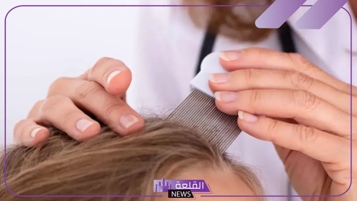 تفسير حلم القمل في الشعر وقتله للمتزوجه والتخلص منه لابن سيرين 6 القمل الكثير في المنام