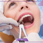 تفسير حلم خلع الاسنان أو سقوط الضرس في المنام لابن سيرين