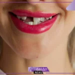 تفسير حلم سقوط سن واحد فقط في المنام للعزباء 