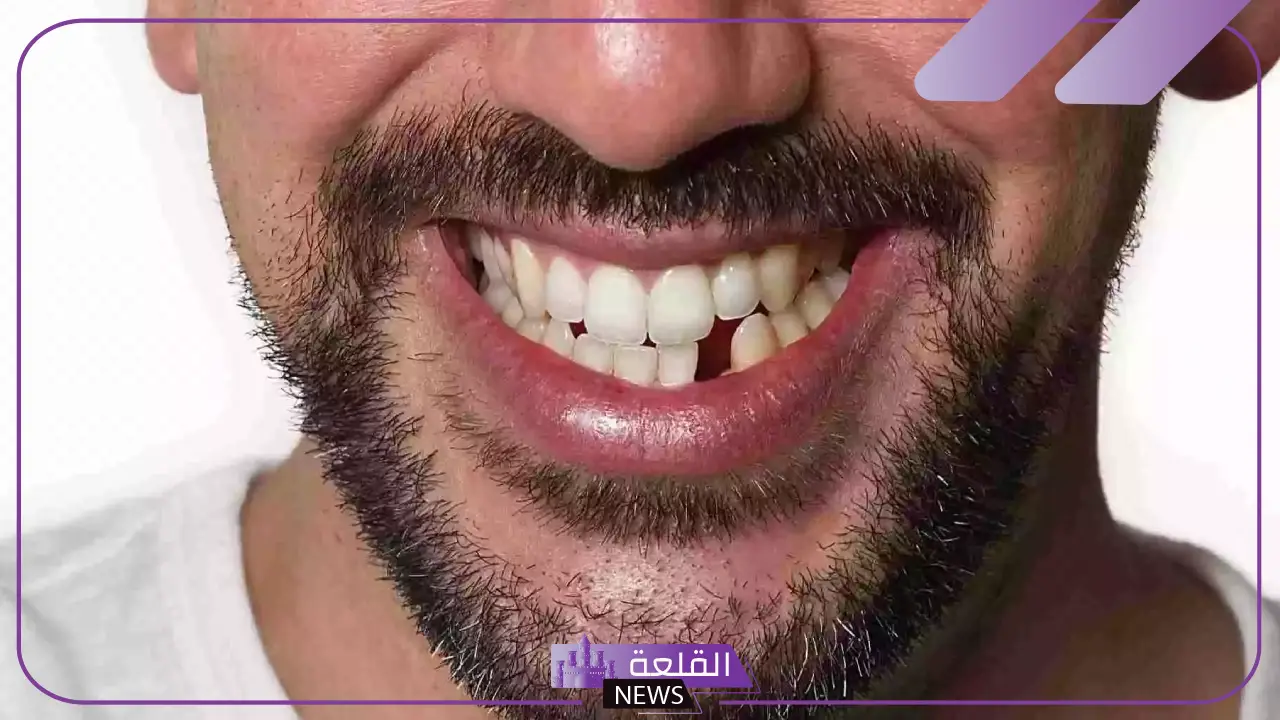 تفسير حلم سقوط سن واحد فقط في المنام للعزباء 6 سقوط السن في منام الرجل