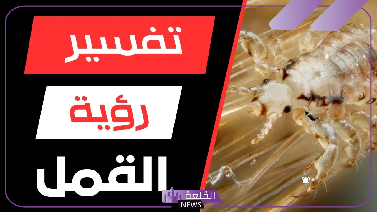 تفسير حلم القمل للمتزوجة في المنام لابن سيرين 5 حلم القمل للمتزوجة في المنام لابن سيرين