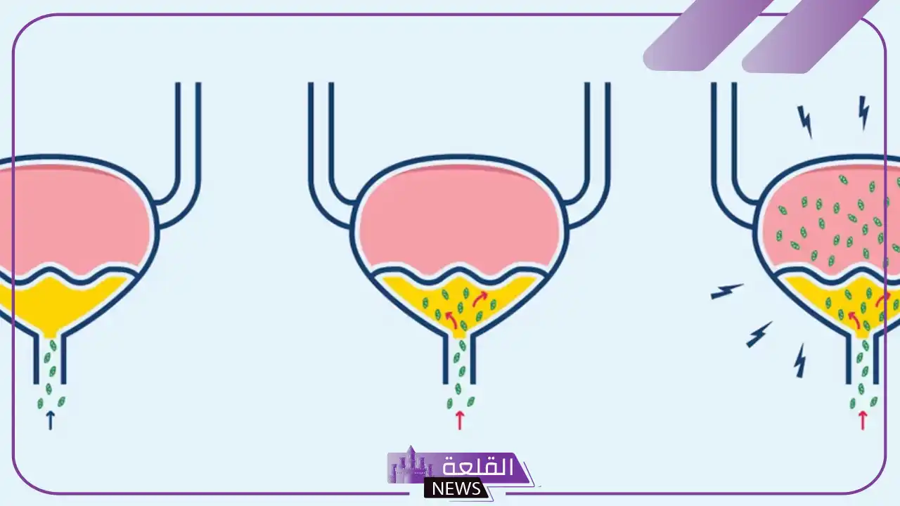 علاج التهاب البول تجربتي في المنزل 6 التهاب البول وألم الرجلين