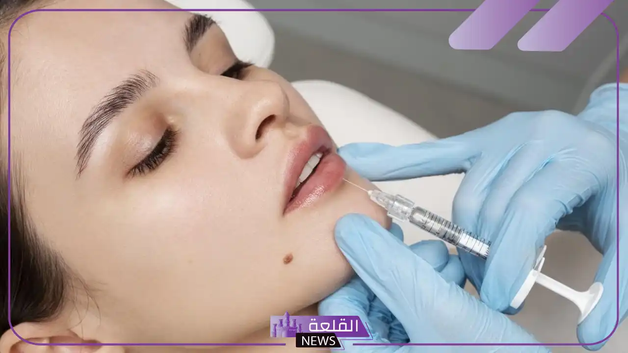 تجربتي مع فيلر جوفيديرم لحقن الشفايف 6 بيع فيلر جوفيديرم