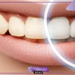 تجربتي مع ازالة جير الاسنان في المنزل بطرق طبيعية