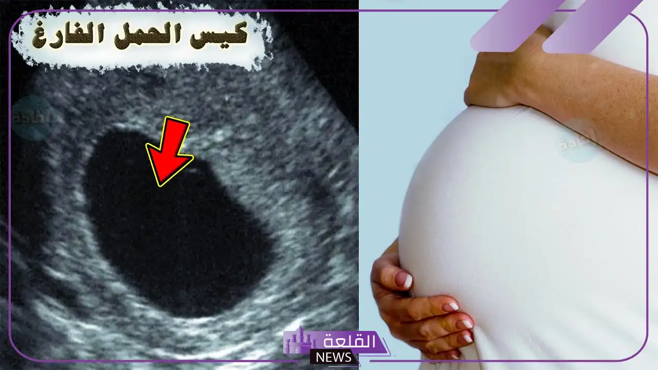 تجربتي مع الحمل بكيس بدون جنين بالأسباب وطرق العلاج 5 أعراض كيس حمل بدون جنين
