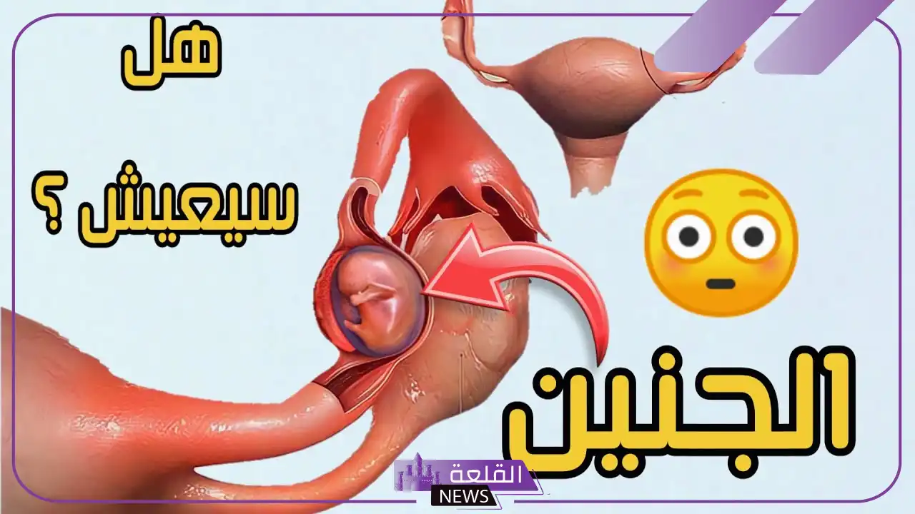 تجربتي مع الحمل خارج الرحم بالأعراض والأسباب تجربتي مع الحمل خارج الرحم بالأعراض والأسباب