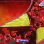 لحماية الكبد.. طعام يقلل من الكوليسترول الضار في الدم ويحمي الكبد