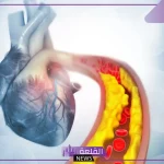 للحماية من انسداد القلب.. نصائح هامة لضمان نظافة الشرايين