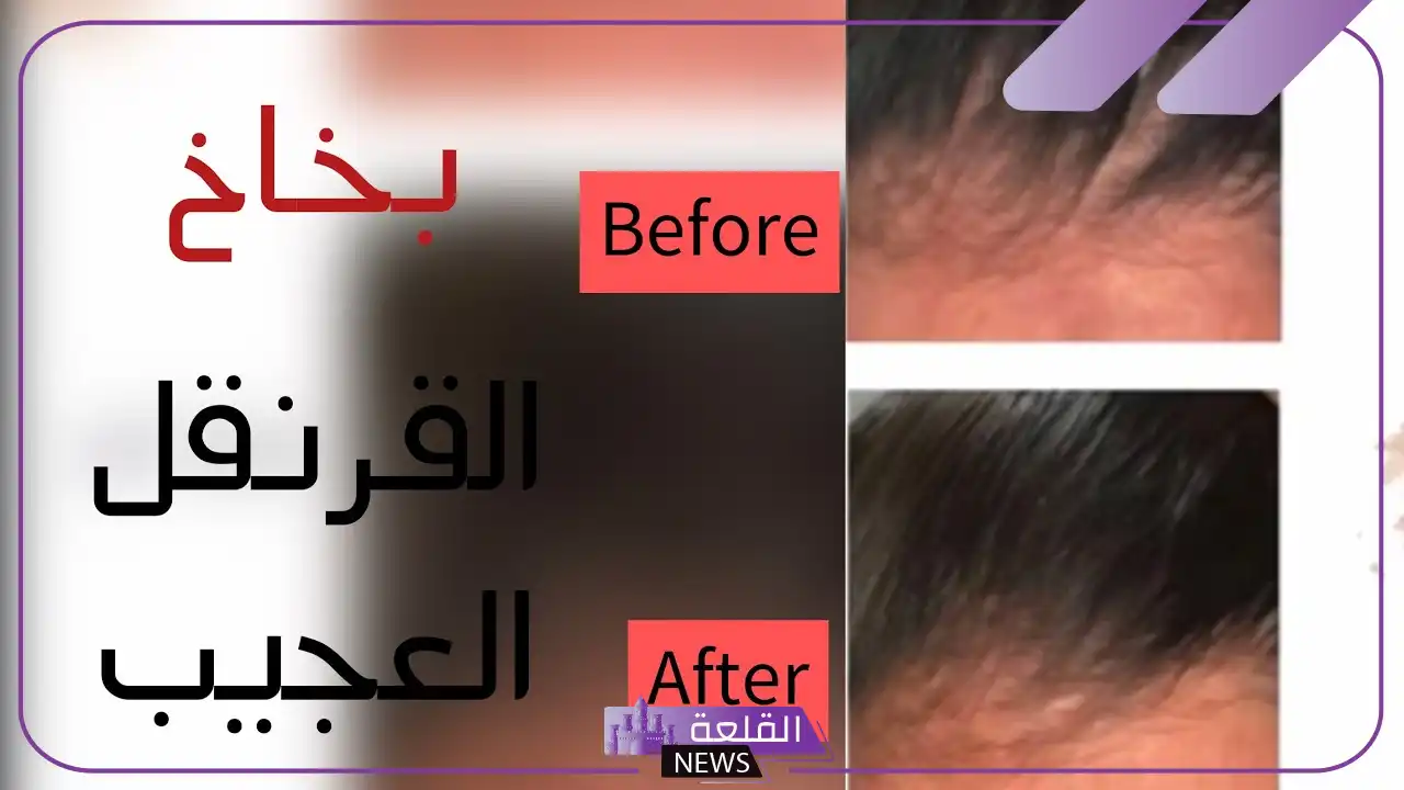 تجربتي مع بخاخ القرنفل للشعر والنتيجة بالفوائد والأضرار 5 أضرار بخاخ القرنفل للشعر