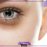 تخلصي منها الآن.. نصائح لإزالة الهالات السوداء والتخلص منها نهائيًا