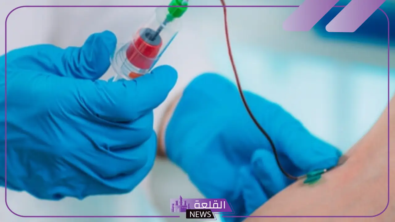 تجربتي مع الفصد وأبرز الأمراض التي يعالجها 