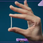 تجربتي مع شريحة منع الحمل وعلاقتها بزيادة الوزن