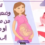 تجربتي في تعديل وضع الجنين قبل الولادة