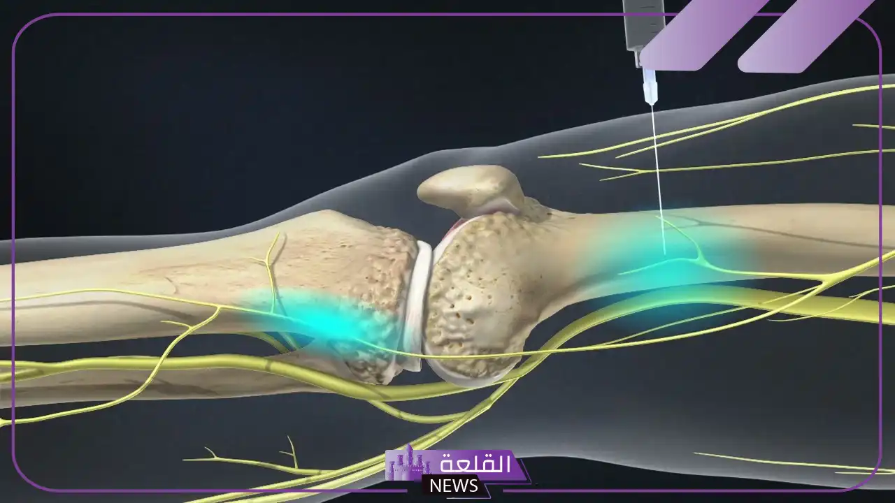 تجربتي في علاج خشونة الركبه وطرق العلاج والأسباب 6 علاج خشونة الركبة من الدرجة الرابعة