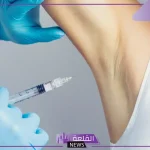 تجربتي مع إبر التعرق بالمميزات والعيوب