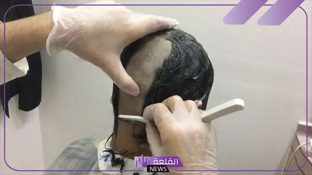 تجربتي مع حلاقة الشعر بالموس بالفوائد والمميزات 5 حلاقة الشعر بالموس