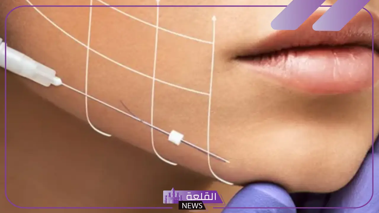 تجربتي مع خيوط شد الوجه كاملة .. هل تتم تحت التخدير؟ 5 تجارب شد الوجه