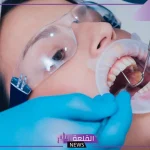 تجربتي مع زراعة الأسنان قبل وبعد وأهم المميزات