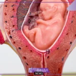 تجربتي مع زيادة الماء حول الجنين وتأثيرها على الولادة