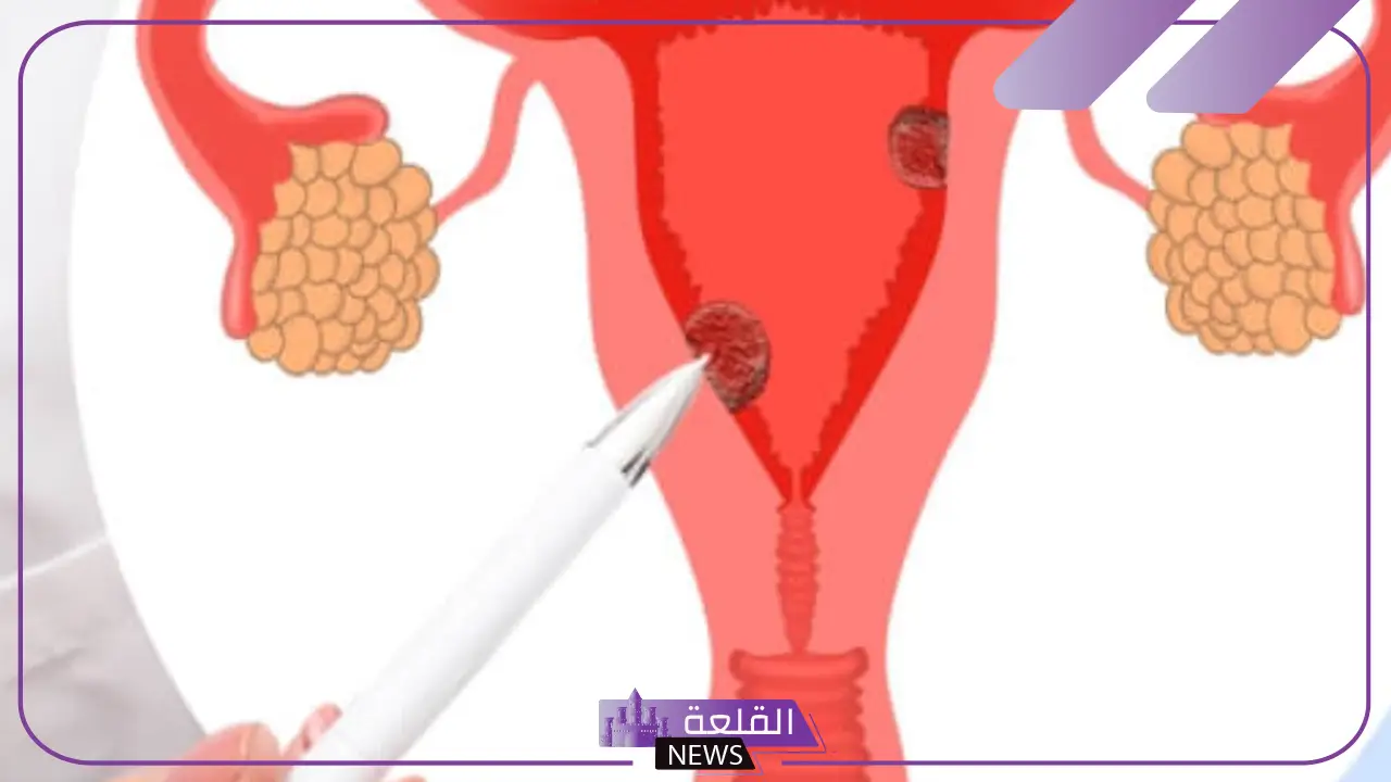 تجربتي مع سماكة بطانة الرحم وأسبابها 5 أسباب سماكة بطانة الرحم