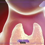 تجربتي مع عقد الغدة الدرقية والأعراض والعلاج بدون جراحة