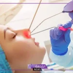 تجربتي مع عملية الجيوب الأنفية بالمنظار