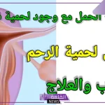 تجربتي مع لحمية الرحم ومتى تكون خطيرة