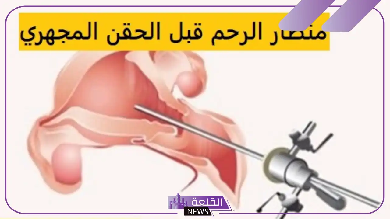 تجربتي مع منظار الرحم .. مين عملت منظار الرحم وحملت؟ 6 مين عملت منظار للرحم وحملت