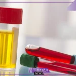 حلمت اني اتبول دم في المنام للمتزوجة والعزباء لابن سيرين