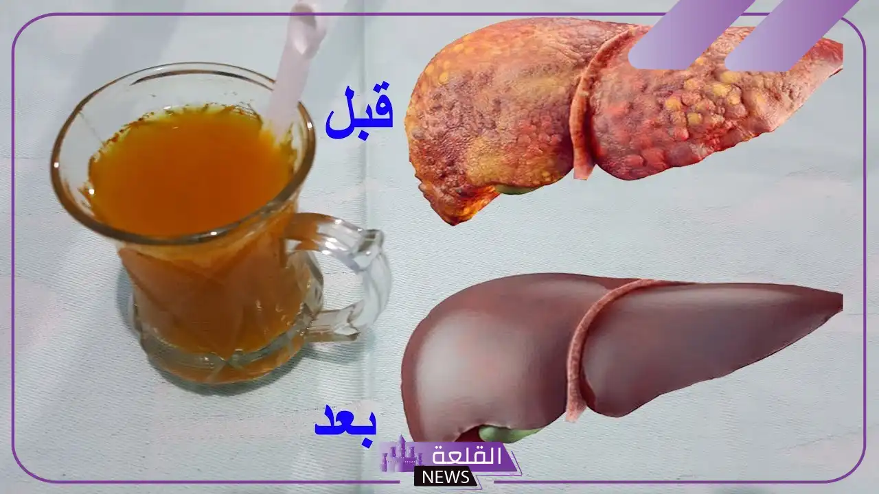 تجربتي مع تنظيف الكبد من السموم في يوم واحد تجربتي مع تنظيف الكبد من السموم في يوم واحد