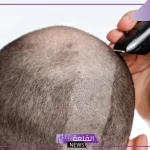 تجربتي مع حلاقة الشعر بالموس بالفوائد والمميزات