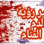 تفسير حلم النزيف في المنام وتوقفه للعزباء لابن سيرين