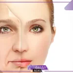 تجربتي مع خيوط شد الوجه كاملة .. هل تتم تحت التخدير؟