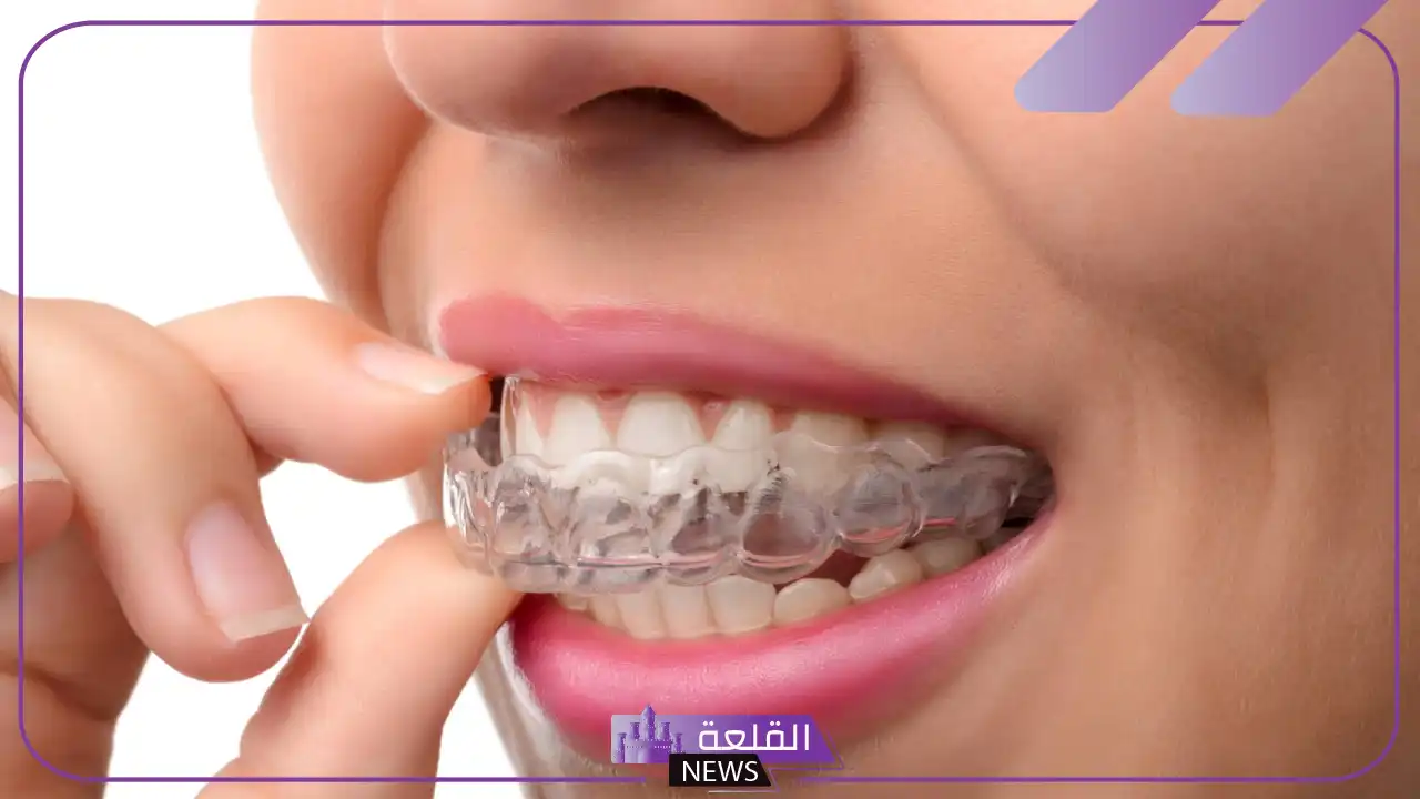 تجربتي مع التقويم الشفاف من البداية حتى النهاية 6 تجربتي مع التقويم الشفاف عالم حواء