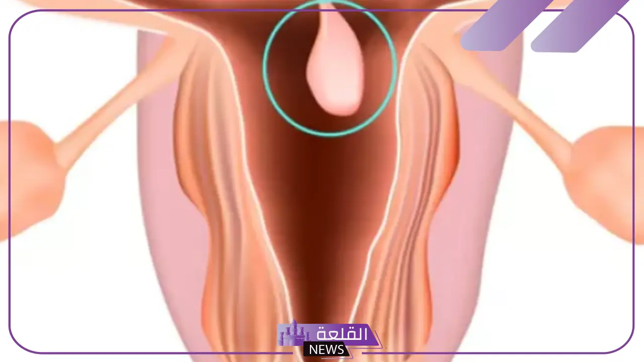 تجربتي مع سماكة بطانة الرحم وأسبابها 6 مشكلات سمك بطانة الرحم