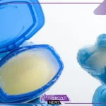 تجربتي في علاج الشرخ بالفازلين بالطرق الطبيعية دون جراحة