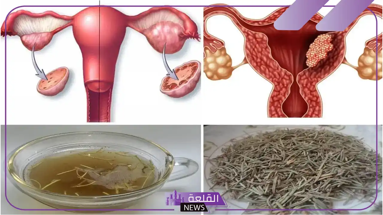 تجربتي في علاج هواء الرحم بعد معاناة وعلاج هواء المهبل 5 أعشاب تخرج الهواء من الرحم