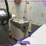 تجربتي مع جهاز ديكا ليزر لإزالة الشعر .. مميزات جهاز ديكا ليزر