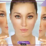 تجربتي فراكشنال ليزر للوجه لعلاج حب الشباب