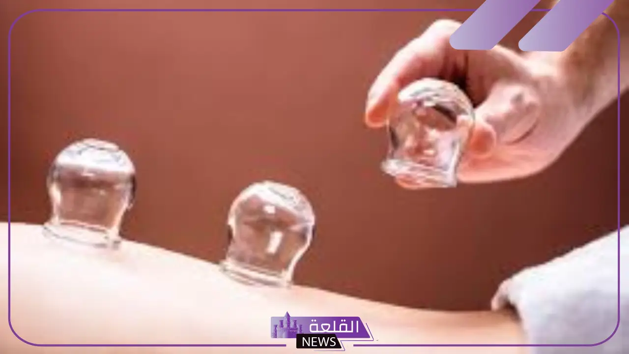 مستشار في التأهيل الطبي.. الحجامة تساهم في تحسن الدورة الدموية للمريض