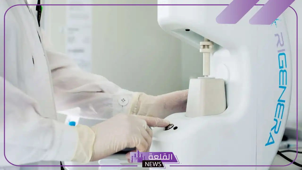تجربتي مع الريجينيرا لعلاج الصلع الوراثي بالفوائد والأضرار 5 الفرق بين الريجينيرا والبلازما